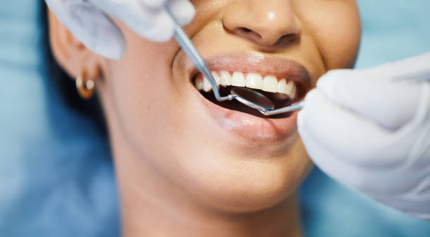 Best Urgent Tooth Repair  in Camn, DE