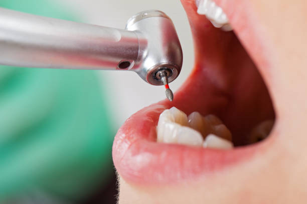 Best Urgent Tooth Repair  in Camn, DE